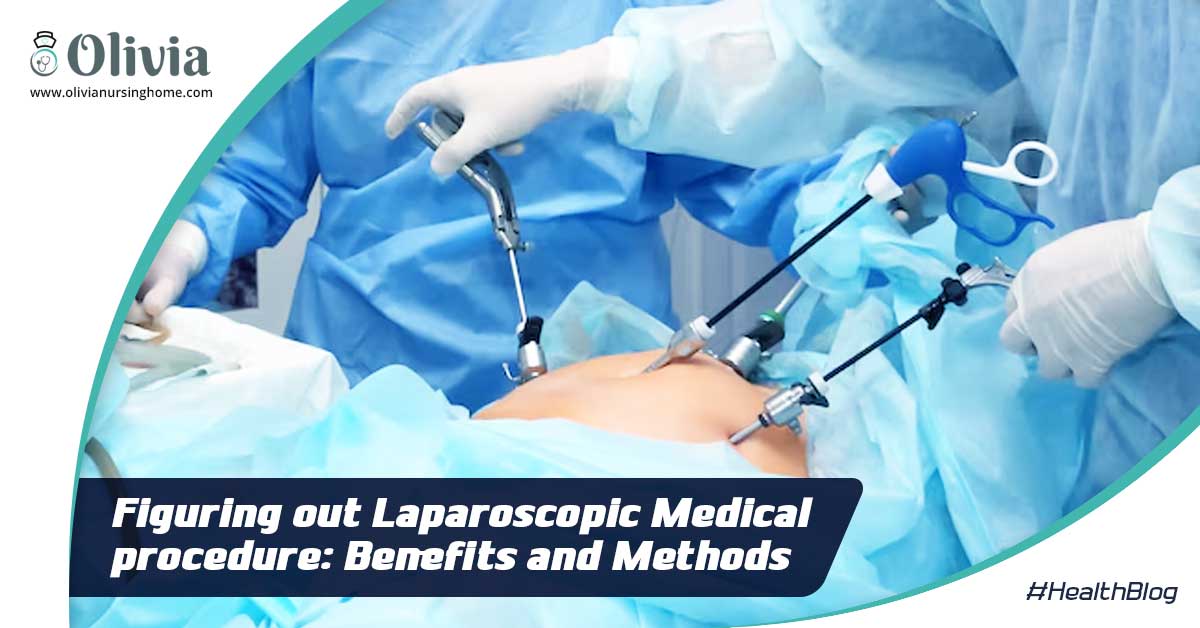 Figuring out Laparoscopic Medical procedure: Benefits and Methods